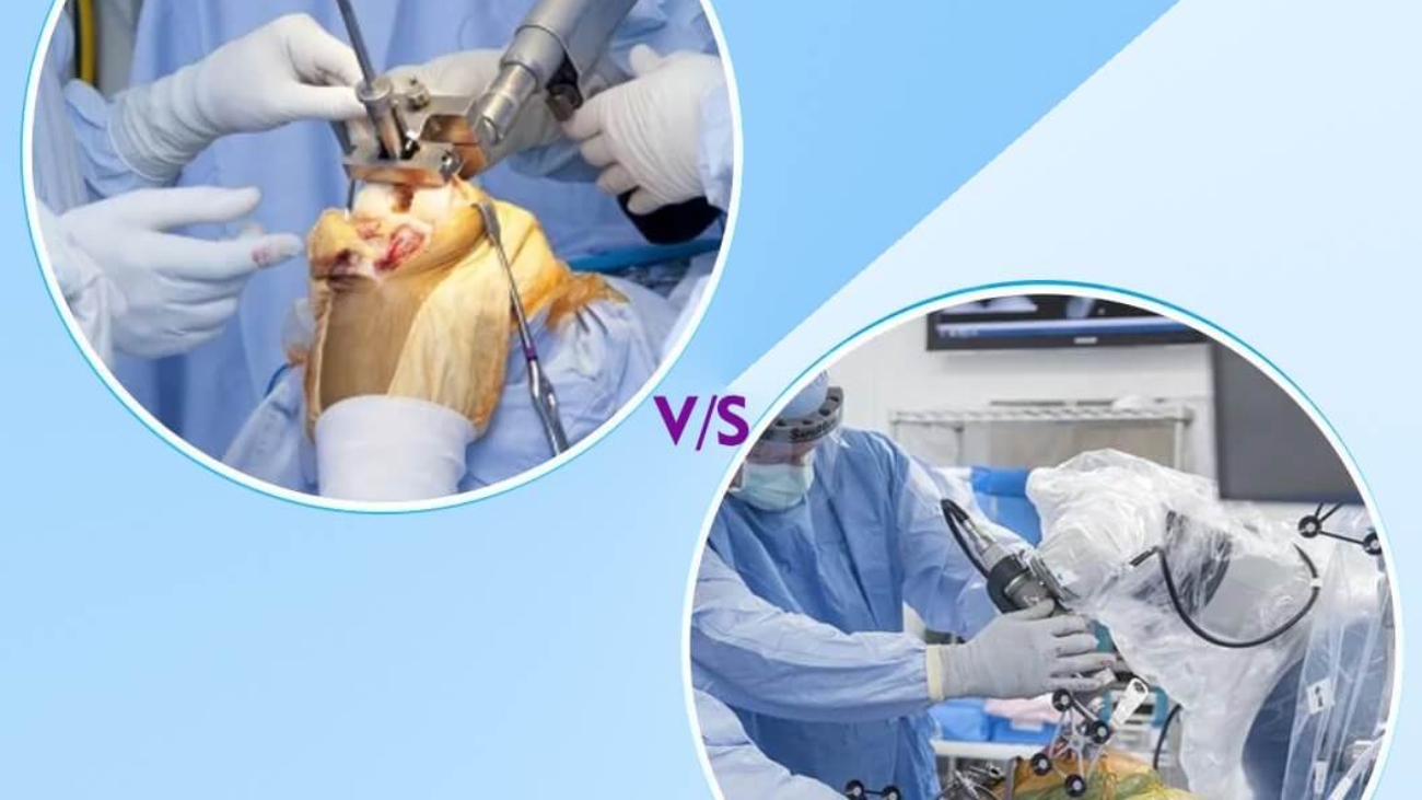 Traditional vs Robotic TKR (1)