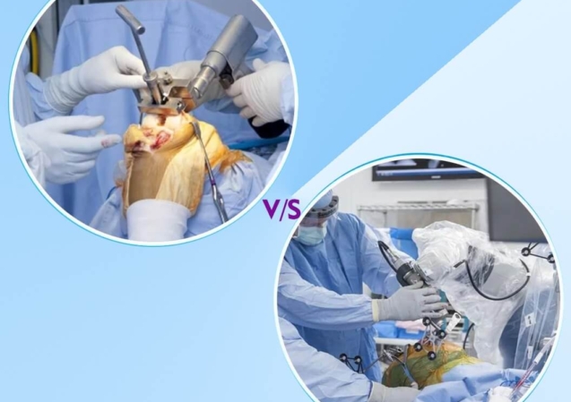 Traditional vs Robotic TKR (1)