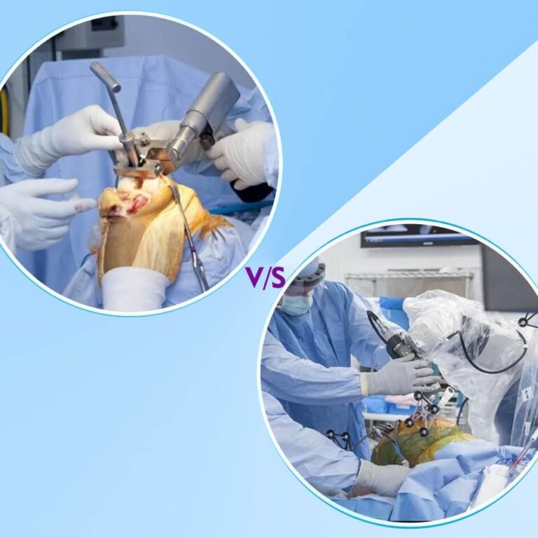 Traditional vs Robotic TKR (1)